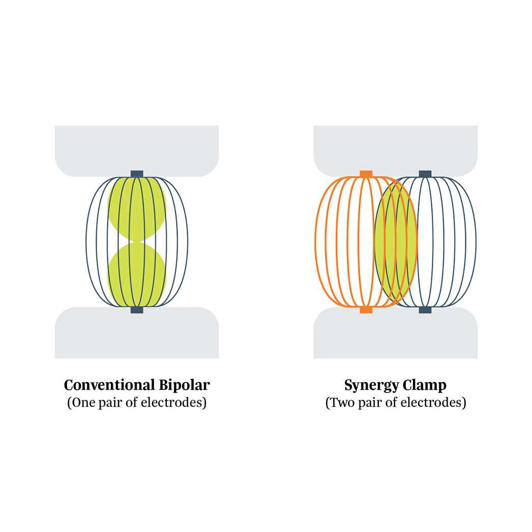 AtriCure Isolator Synergy AtriCure Isolator Synergy